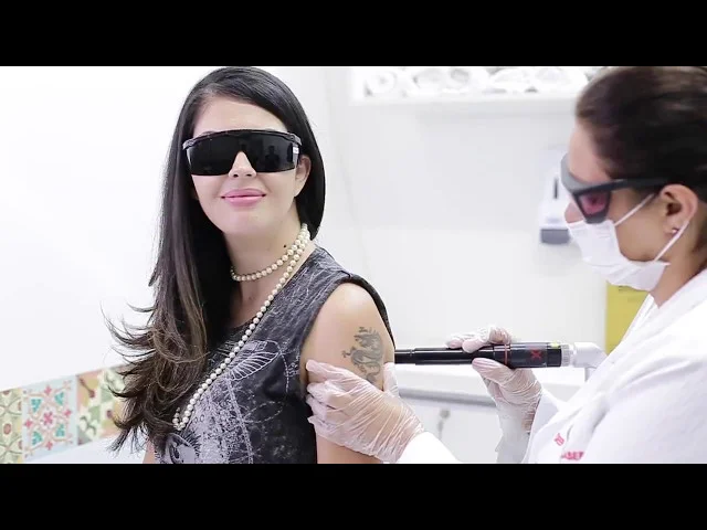 Vídeo sobre remoção de tatuagem